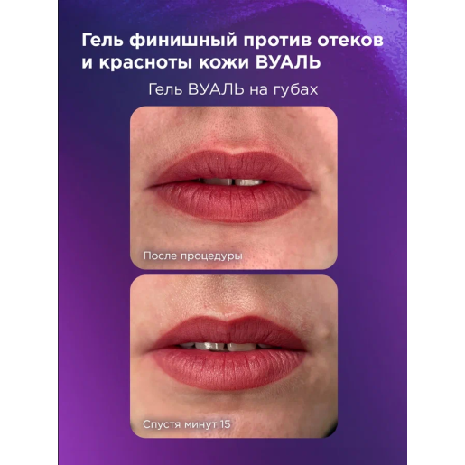 NE Pigments - #617 Финишный гель против отёков и красноты "Вуаль" 10 мл